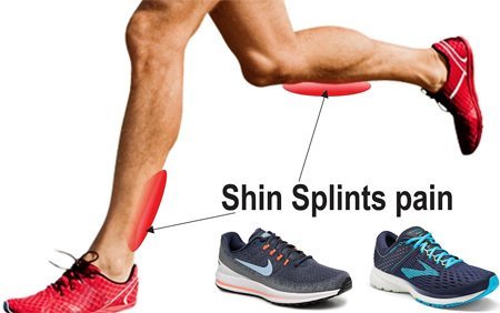 15 Best Running Shoes for Shin Splints 
